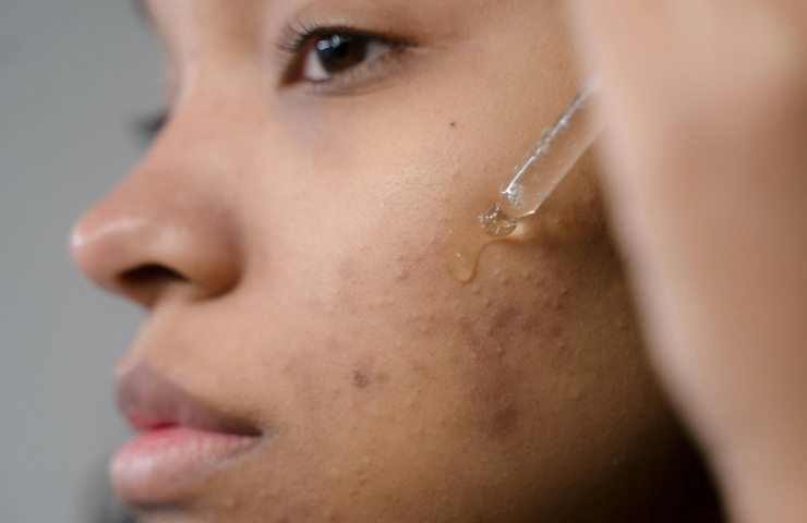 PHA Toner: Trending in Beauty Influencer Marketing